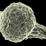 La variante Makona del virus del ébola cubre la superficie de una célula infectada.